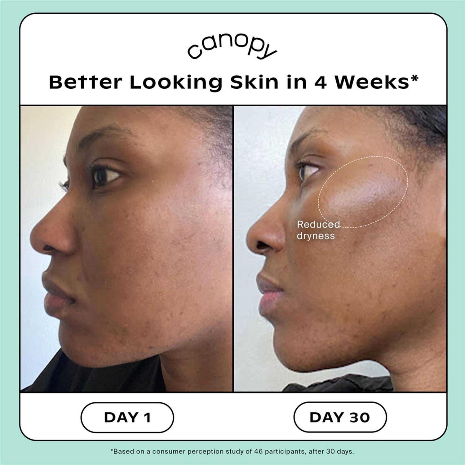 Canopy Humidifier Starter Set - Image 4